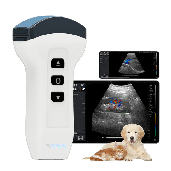 Wireless Probe Color Doppler Ultrasound Scanner